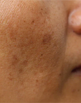 {"type":"root","children":[{"type":"paragraph","children":[{"type":"text","value":"dullness","bold":true}]}]}