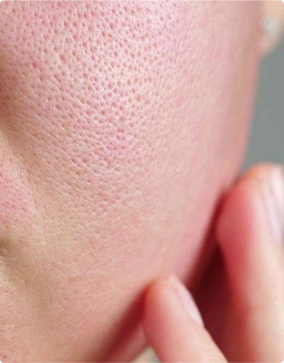 {"type":"root","children":[{"type":"paragraph","children":[{"type":"text","value":"sensitive skin","bold":true}]}]}